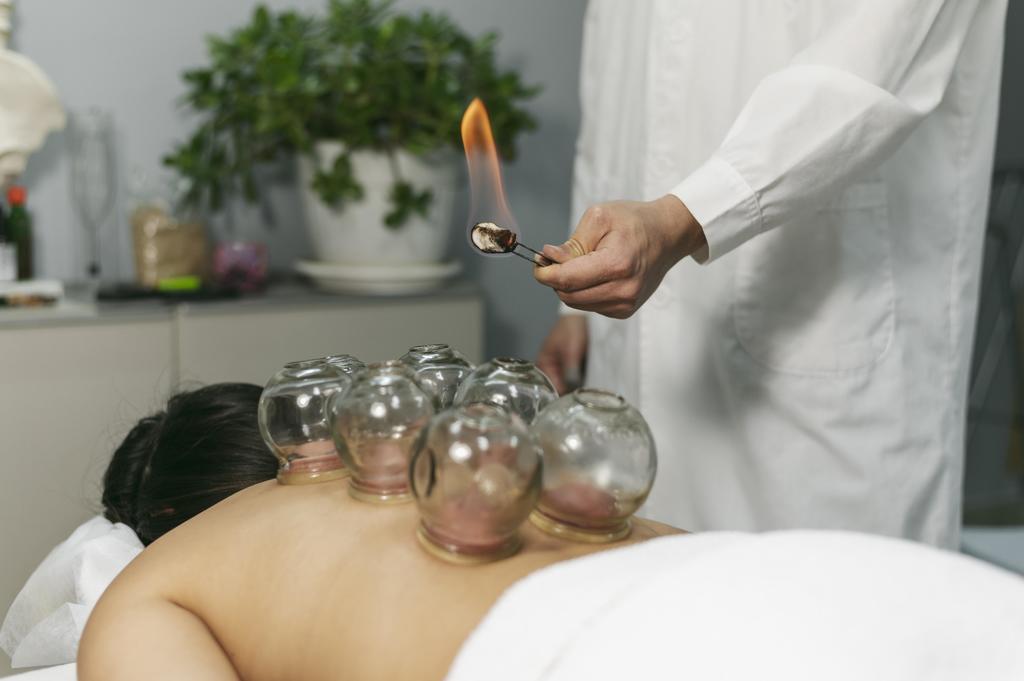 CUPPING THERAPY - THE HEALING POWER OF THE FIRE AND THE GLASS